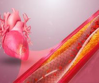 article thumbnail